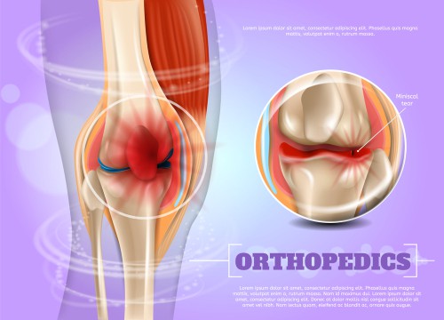 Realistic,Illustration,Orthopedics,Medicine,In,3d.,Banner,Image,Closeup,Anatomy
